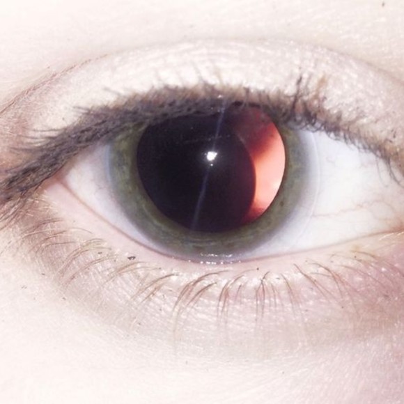 onyxeye_